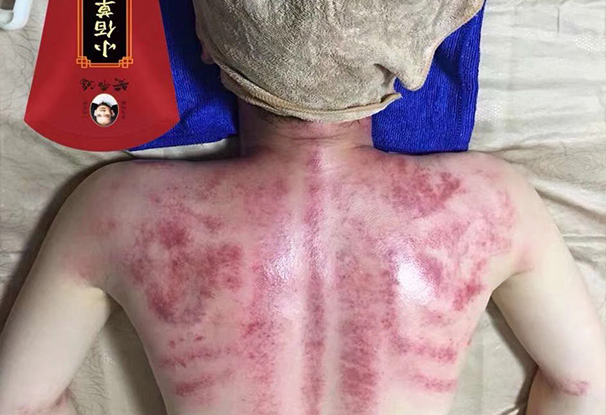 黄飞鸿小佰草抑菌液案例
